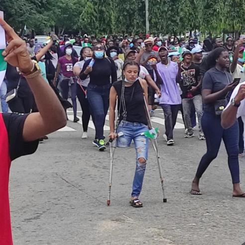 Nigerians raise over N3m for EndSARS protester to get a prosthetic leg